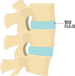 정상 디스크 이미지