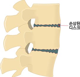손상된 디스크 이미지