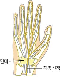 정상 관절 이미지